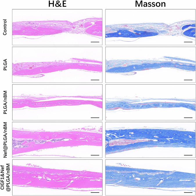 The photos of H&E and Masson’s trichrome staining of specimens at 8 weeks postoperatively. Bar = 100 μm