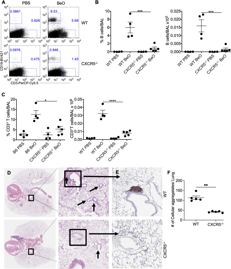 CXCR5 expression is required for B cell recruitment to the lung in response to BeO exposure. WT and CXCR5-/- mice were sensitized with seven doses of BeO (100 μg) on days 0, 1, 2, 14, 15, 18, and 19 and sacrificed on day 21. (A) Representative dot plot shows the presence of CD19+ and CD3+ T cells and (B) cumulative percent frequency (left) and total number (right) of B cells in the BAL of BeO-exposed mice. (C) Percent frequency (left) and the total number of CD3+ T cells (right) in the BAL of BeO-exposed WT and CXCR5-/- mice on day 21. (D) Hematoxylin and eosin staining and (E) immunohistochemical (IHC) staining of B cells using an anti-rabbit B cell antibody of BeO-exposed lung tissues. (F) Cellular aggregates in the lungs of WT and CXCR5-/- mice were quantified using QuPath. Data are representative of three independent experiments, 4-5 mice per group. One-way ANOVA was used to test statistical differences among the groups. P<0.05 (*) is considered statistically significant. P < 0.05 (*), P < 0.01 (**), P < 0.001 (***), P < 0.0001 (****).