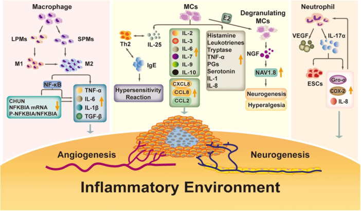 This figure shows how inflammation is involved in the pathogenesis of endometriosis and could induce angiogenesis. This is a reuse of an original figure under Creative Commons Attribution 4.0 International License belongs to the following citation. Wei Y, Liang Y, Lin H, Dai Y, Yao S. Autonomic nervous system and inflammation interaction in endometriosis‐associated pain. J Neuroinflammation. 2020;17(1):80. COX‐2, cyclooxygenase‐2; E2, estradiol; IL, interleukin; LPM, large peritoneal macrophage; MC, Mast cells; NFKBIA, NF‐κB inhibitor alpha; PG, prostaglandin; SPM, small peritoneal macrophage; TGF‐β, transforming growth factor β; Th2, T helper 2; TNF‐α, tumor necrosis factor‐α; VEGF, vascular endothelial growth factor.