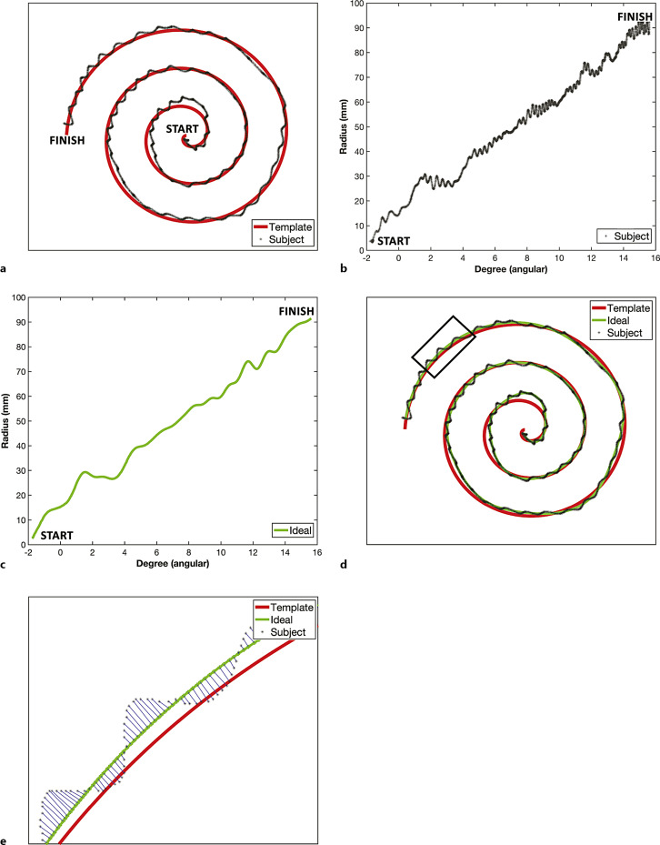 Diagram of spiral analysis. a The red line is the spiral template displayed on the tablet. The black line is a hand-drawn spiral. b The hand-drawn spiral (black line in A) was unraveled/converted to polar (radius-angular) coordinates. c The ideal spiral (green line) is the ideal (best-fit) spiral of the unraveled hand-drawn spiral (black line in B). d The participant’s hand-drawn spiral (black) is now superimposed on the ideal spiral, which has converted back to (x, y) Cartesian coordinates for display purposes (green) and the template spiral (red). e The area selected in the box from (d) is magnified to show the subject’s data points (arrowed lines) and the ideal spiral line (solid green line). The radial errors are then calculated to generate the tremor amplitudes: rsubject,i – rideal,i.
