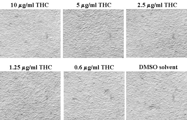 THC is not toxic to NIH3T12 cells. NIH3T12 cells seeded at about 1/4th of confluency were cultured for 48 h in the presence of various concentrations of THC (0.625–10 μg/ml) and photographed.
