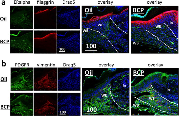 Expression of filaggrin (red) and estrogen alpha (green) (a), and PDGFR (green) and vimentin (red) (b) in the wounded area of mice. (a) View at the wound edge. In: intact area, WE: wound edge, WB: wound bed. Scale bar is in μm. Dotted lines show the boundaries between the intact area and wound edge, and the wound edge and wound bed. Filaggrin staining of the BCP group was broader in width and longer in the distance from the wound edge. Estrogen alpha staining did not show obvious differences between groups. (b) PDGFR expression in the epidermis was stronger in the BCP group. Both the BCP and Oil group showed a large area of staining of PDGFR in the wound edge (WE) and wound bed (WB). Vementin staining did not show obvious differences between the BCP group and Oil group. In: intact area, WE: wound edge, WB: wound bed. Scale bars are in μm.
