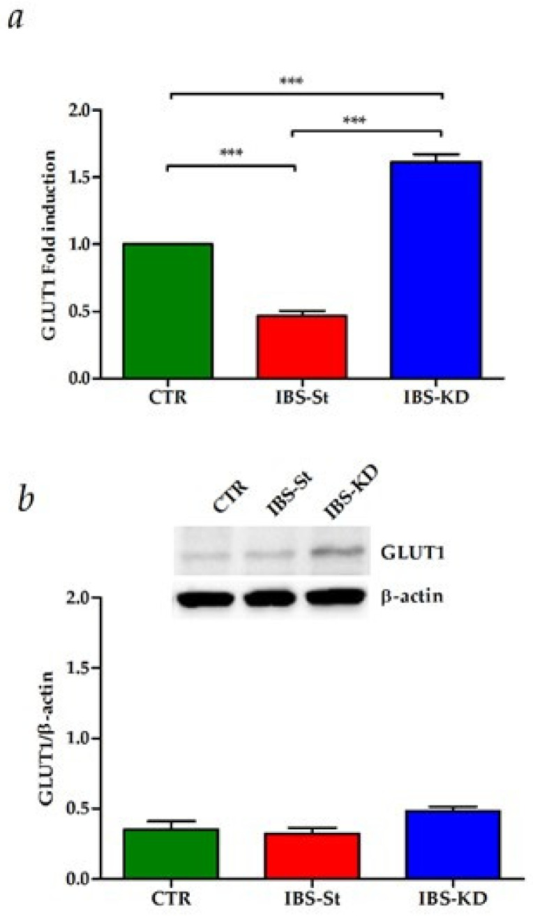(a) GLUT1 gene expression levels in the control group (CTR), IBS rats fed a standard diet (IBS-St), and IBS rats treated with low-carbohydrate, high-fat ketogenic diet (IBS-KD); (b) GLUT1 protein expression levels and representative blots in the control group (CTR), IBS rats fed a standard diet (IBS-St), and IBS rats treated with low-carbohydrate, high-fat ketogenic diet (IBS-KD). All data represent the results of three different experiments (mean ± SD). p-value was determined by ANOVA with Tukey’s multiple comparison test; *** p < 0.001.