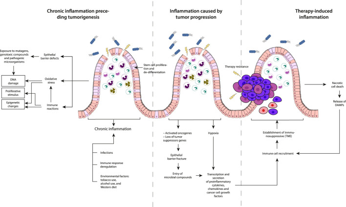 Description of the three types of inflammation based on their timing concerning cancer development: Chronic inflammation preceding tumorigenesis, Inflammation caused by tumor progression and Therapy-induced inflammation.