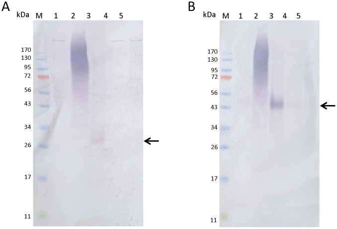 Expression of PpPer1 and PpPer3 in P. papatasi midgut lysates.Expression of native PpPer1 and PpPer3 in P. papatasi midgut lysates was assessed using one midgut equivalent (from pools of five guts for each time point) of non blood fed and blood fed P. papatasi per lane. Lanes: M, size marker; 1, non blood fed midgut; 2, blood fed midgut dissected 24 h PBM; 3, blood fed midgut dissected 48 h PBM; 4, blood fed midgut dissected 72 h PBM; 5, blood fed midgut dissected 96 h PBM. Proteins were transferred to nitrocellulose and blots were incubated with anti-PpPer1 (A) and with anti-PpPer3 (B) specific antisera. Arrows point the native proteins PpPer1 (A) and PpPer3 (B).