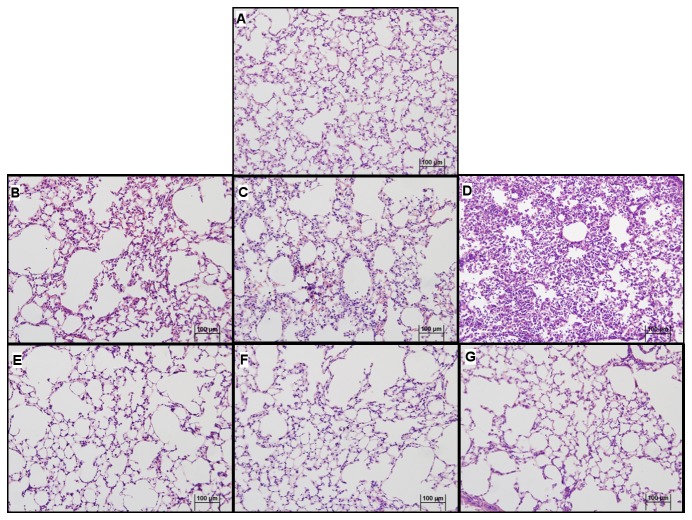 JZL184 effects on lung architecture in LPS-induced lung damage.(A) Non inflamed control; (B) Inflamed control 6 hours, (C) Inflamed control 24 hours and (D) Inflamed control 48 hours after LPS intranasal instillation; (E) JZL184 treated animals 6 hours, (F) JZL184 treated animals 24 hours and (G) JZL184 treated animals 48 hours after LPS intranasal instillation. Sections from the left lung lobe were stained with hematoxylin and eosin. Representative pictures are shown for each experimental group (magnification = 200X).