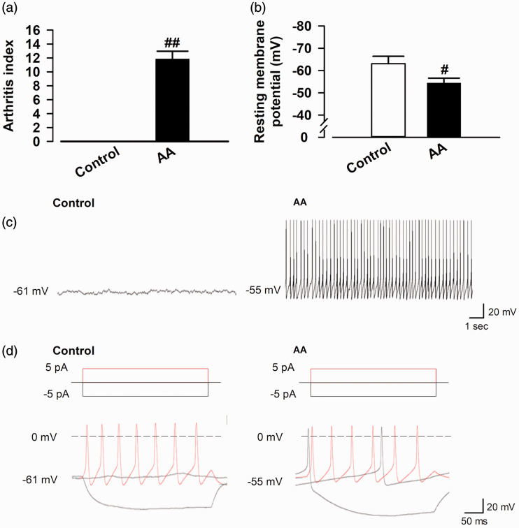 Electrophysiological response of OXT-mRFP1 neurons in the magnocellular PVN using whole-cell patch-clamp recordings. (a) The arthritis index in control and AA rats (control group: n = 6 rats; AA group: n = 6 rats). (b) Representative pooled results showing resting membrane potentials (RMPs) (mV) in control and AA rats (control group: n = 15 neurons/7 rats; AA group: n = 19 neurons/8 rats). (c) Representative RMPs in control and AA rats. (d) Example AP firing pattern of an OXT-mRFP1 neuron in current-clamp mode by induction of currents in control and AA rat (from −5 pA to +5 pA with 5 pA) for 400 ms. #p < 0.05 and ##p < 0.01 compared with control. AA: adjuvant arthritis.