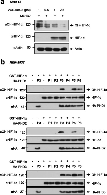 Effect of VCE-004.8 on PDH activity and HIF-1α hydroxylation and stabilization. a MO3.13 cells were treated with VCE-004.8 for 6 h in the presence of MG132 and the levels of hydroxylated HIF-1α and HIF-1α were determined by immunoblot (n = 3). b HEK-293T cells were transfected with HA-PHD1, HA-PHD2, or HA-PHD3 as indicated. After 24 h of transfection, cells were treated as follows: P1, non-transfected cells; P2, cells were transfected with PHDs and immunoprecipitated with IgG-HA; P3, cells were transfected with PHDs and immunoprecipitated with αHA; P4, cells transfected with PHDs, stimulated with VCE-004.8 (2.5 μM) and immunoprecipitated with αHA; P5, cells transfected with PHDs, stimulated with CBD (2.5 μM) and immunoprecipitated with αHA; P6, cells transfected with PHDs, stimulated with DMOG (1 mM) and immunoprecipitated with αHA. HIF prolyl hydroxylase activity was measured using GST-HIF-1α protein, and the levels of hydroxylated HIF-1α, HIF-1α, and PHDs were analyzed by immunoblot (n = 3)