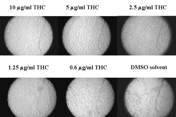 THC inhibits MHV 68 cytopathic effect in NIH3T12 cells. Photograph of NIH3T12 infected with MHV 68 at a multiplicity of 2. Plates were cultured for 48 h in the presence or absence of various concentrations of THC (0.625–10 μg/ml) or equivalent volumes of DMSO.
