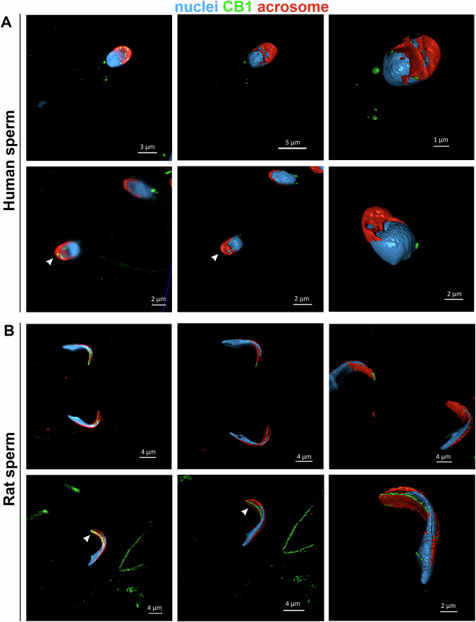 CB1 head spots are localized in the internal part of the acrosome.High-resolution confocal images of human (A) and rat (B) sperm showing CB1 head spots (green) in human sperm. 3D reconstructions obtained after Airyscan processing confirm that some CB1 head spots (indicated by white arrow heads) are located beneath the outer acrosomal membrane. The acrosome was stained with Alexa Fluor™ 568-conjugated Lectin PNA (red), and nuclei were counterstained with DAPI (blue).