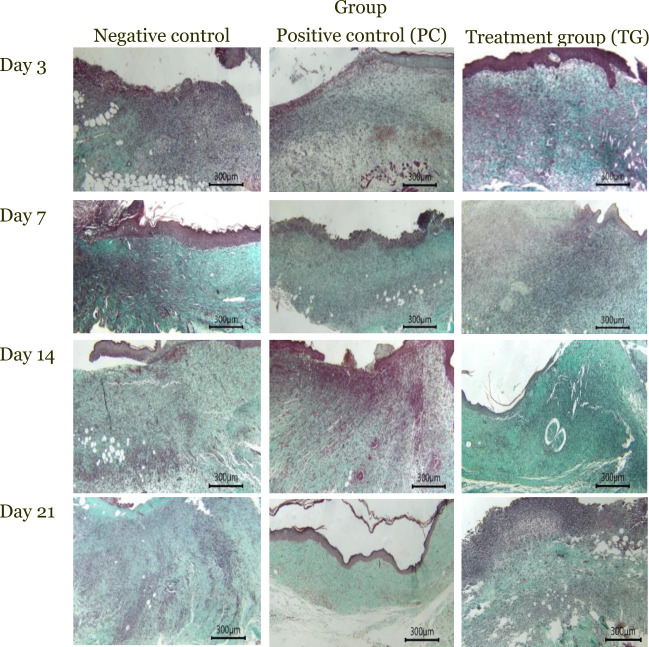Histopathological evaluation of epithelialization at 400× magnification revealed minimal epithelialization on day 3, with progressive increases observed on days 7, 14, and 21. The treatment group (TG) and positive control (PC) group demonstrated greater epithelialization thickness, while the negative control (NC) group showed only moderate progression.
