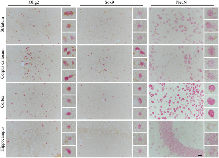 The cell- and side-specific expression of four repeats of tau (4R) isoform in hTau animals brain. The high-power microphotography of double immunohistochemistry staining of 4R tau isoform (RD4, brown chromogen) combined with oligodendrocytes (Olig2, left panel, red/pink chromogen), astrocytic (Sox9, middle panel, red/pink chromogen) or neuronal (NeuN, right panel, red/pink chromogen) markers. The representative pictures of four brain regions: striatum (upper panel), corpus callosum (second upper panel), cortex (third upper panel), and hippocampus (lower panel) with higher magnification of representative cells on the right side of each image. In striatum and corpus callosum only oligodendrocytes were RD4 positive, and no RD4 immunoreactive astrocytes or neurons were detected. In cortex only, some oligodendrocytes and rear neurons were RD4 positive, and no RD4 immunoreactive astrocytes were identified. Similarly, in the hippocampus, no astrocytes were RD4 positive, and only some oligodendrocytes and neurons were weakly RD4 immunoreactive. The scale bar represents 25 μm and applies to all pictures; inserts represent 4× digital enlargement.