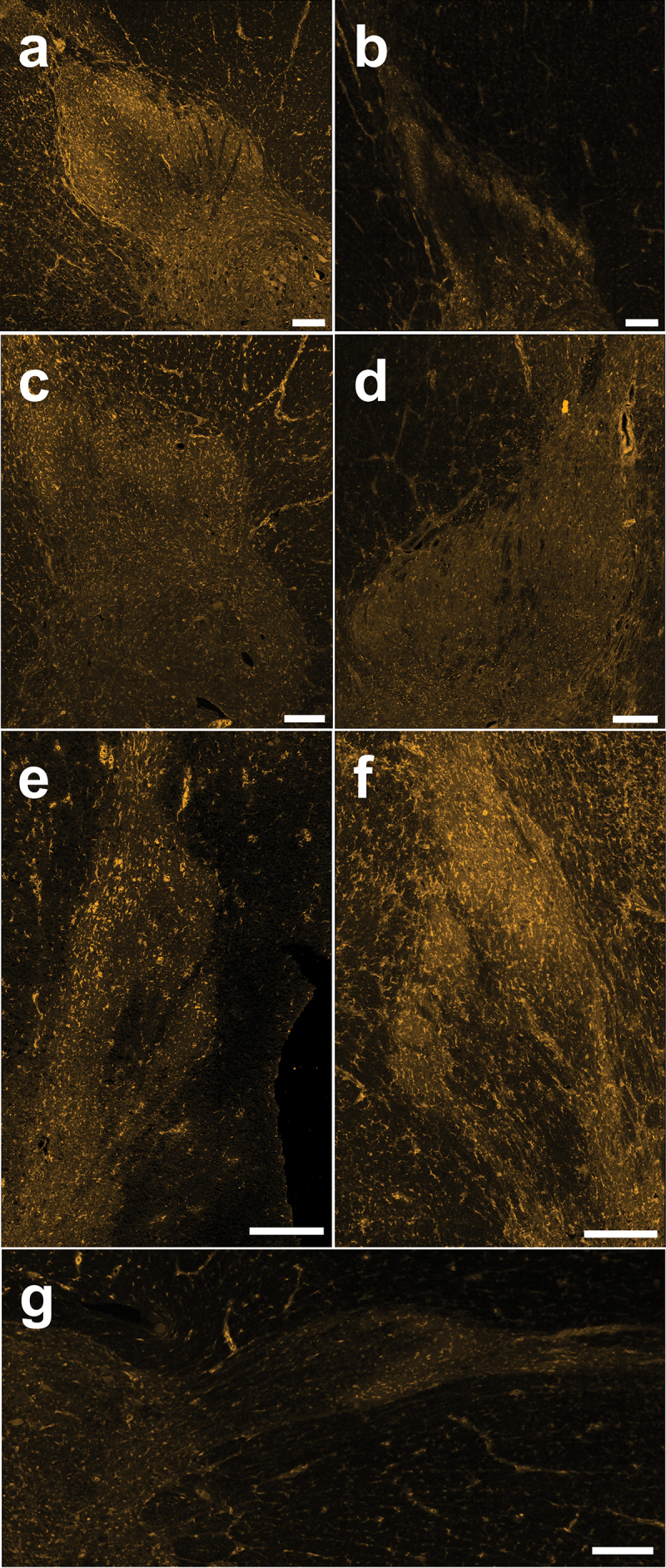 Immunoreactivity of the CB1 receptor in thoracic and lumbar spinal cord sections from female human organ donors. (A)–(G) Representative confocal images (20× objective) of CB1 immunostaining from each female human (n = 7) showing neuropil staining that is especially pronounced in the SDH and cellular staining across the DH. Scale bar = 200 µm.