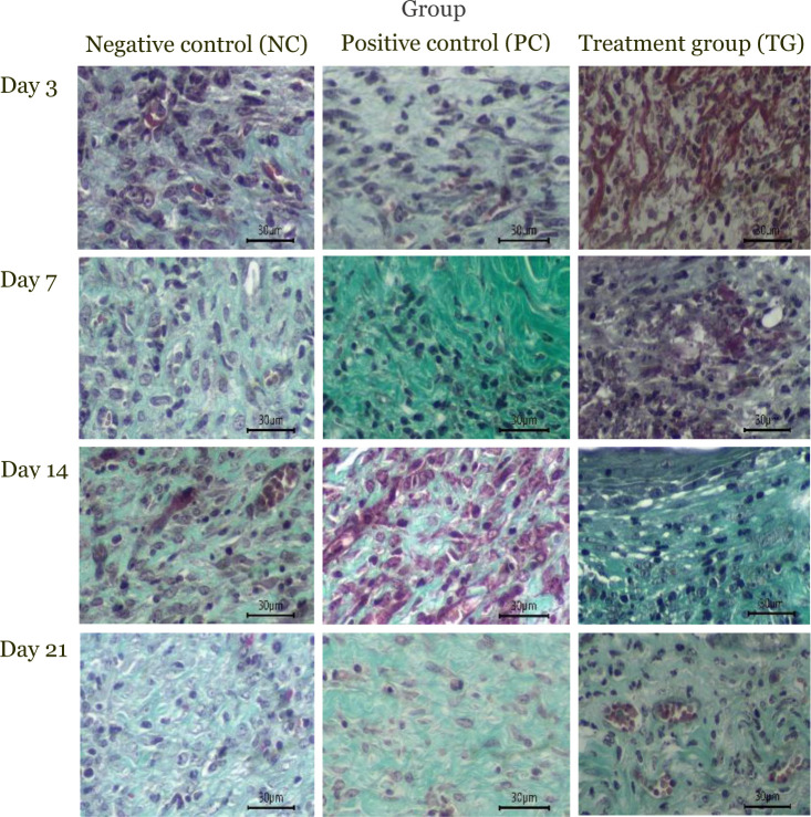 Histopathological evaluation of vascularization under 400× magnification revealed a gradual increase in new blood vessel formation on days 3, 7, 14, and 21 across all experimental groups. The treatment group (TG) group exhibited a higher number of new blood vessels compared to the NC group, indicating enhanced vascularization.