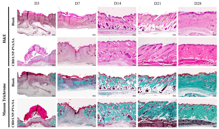 Effects of cannabidiol-loaded lipid nanoparticles incorporated into polyvinyl alcohol and sodium alginate (CBD/LNP-PVA/SA) hydrogel scaffold on histopathological changes in rat skin on days 3, 7, 14, 21, and 28 post-wounding, as assessed by H&E and Masson’s trichrome staining. Photographs show wound sections from rats treated with PVA/SA (Blank) and CBD/LNP-PVA/SA hydrogel scaffold. Hematoxylin-stained nucleic acids and nuclei, eosin-stained proteins, and collagen are visualized in blue–green. Scale bar = 200 μm.