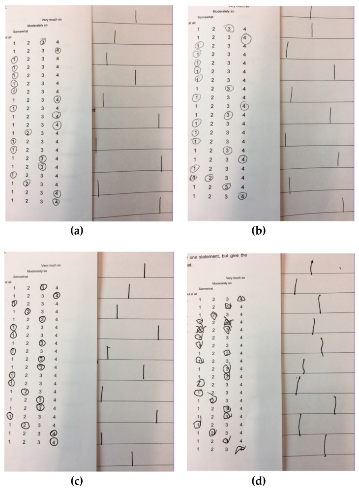 Difficulty in motor coordination and indecisiveness. (a) Before placebo administration; (b) After placebo administration; (c) Before delta-9-tetrahydrocannabinol administration; (d) After delta-9-tetrahydrocannabinol administration.