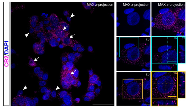 Localization of CB2 receptors. Representative confocal images showing CB2 immunostaining (magenta) in HepG2 cell line. Nuclei are stained with DAPI (blue). Pictures are shown as max z-projections (low magnification; left) with white arrows and arrowheads to highlight CB2high+ cells and CB2low+ cells, respectively, and a single confocal plane with reslicing (right) to better appreciate the intracellular distribution of CB2+ puncta in two of the cells present in the image. The cyan contoured image shows a cell positive for CB2 at low levels; the yellow contoured image identifies a cell with extensive immunolabelling for CB2. Scale bars: 50 µm (low magnification) and 10 µm (high magnification).