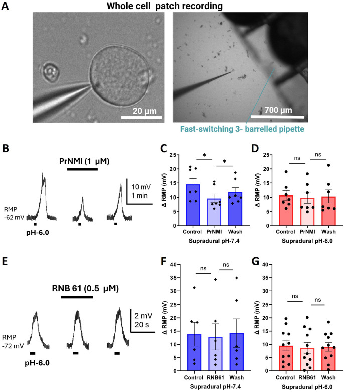 PrNMI decreases acid-induced depolarization in neurons isolated from control but not acid-treated mice.A: Schematic representation of fast switching perfusion experiment. B: PrNMI reversibly decreased the response to pH-6.0 of an FG+ve TG neuron from a supradural pH-7.4-treated mouse. C: Graph of FG+ve TG neuron depolarizing responses before, during, and after a 3-min bath perfusion of PrNMI from mice treated with supradural pH-7.4. * P = 0.0145, F (1.254, 7.525) = 9.177 (one-way repeated measures analysis of variance). pH7.4 = 9 mice. D: Graph of FG+ve TG neuron depolarizing responses before, during, and after a 3-min bath perfusion of PrNMI from mice treated with supradural pH-6.0. P = 0.6132, F (1.033, 6.199) = 0.2952 (one-way repeated measures analysis of variance). pH-6.0 = 6 mice. E: RNB61 did not decrease the response to pH-6.0 of an FG+ve Ad-type TG neuron from a supradural pH-7.4-treated mouse. F: Graph of FG+ve TG neuron depolarizing responses before, during, and after a 3-min bath perfusion of RNB61 from mice that received supradural pH-7.4 injections. P = 0.6227, F (1.285, 6.427) = 0.3585 (one-way repeated measures analysis of variance). pH-7.4 = 2 mice. G: Graph of FG+ve TG neuron depolarizing responses before, during, and after a 3-min bath perfusion of RNB61 from mice that received supradural pH-6.0 injections. P = 0.5870, F (1.539, 15.39) = 0.4822 (one-way repeated measures analysis of variance). pH-6.0 = 8 mice.
