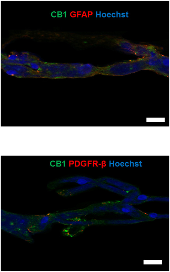 Upper panel: double-labeling immunofluorescence staining of CB1 receptors and GFAP in microvessels isolated from the hippocampus of a non-epileptic autopsy. Lower panel: double-labeling immunofluorescence staining of CB1 receptors and PDGFR-β in microvessels isolated from the temporal neocortex of a patient with DR-MTLE. Cell nuclei were stained with Hoechst (in blue). All scale bars are 20 μm.