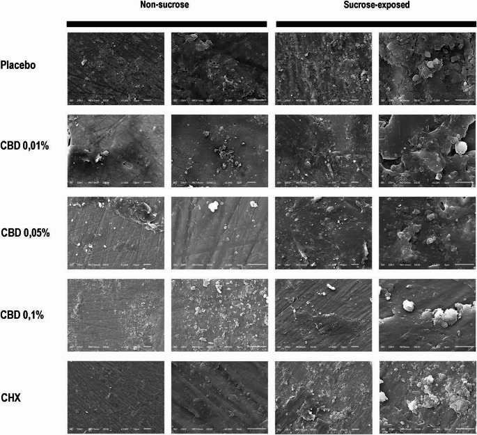 Scanning electron microscopy (SEM) images of enamel surfaces after treatment with different mouthwash. Representative micrographs were obtained at magnifications of 1000× and 5000× for the following groups: Placebo, CBD 0.01%, CBD 0.05%, CBD 0.1%, and CHX 0.12%, under conditions with and without sucrose exposure