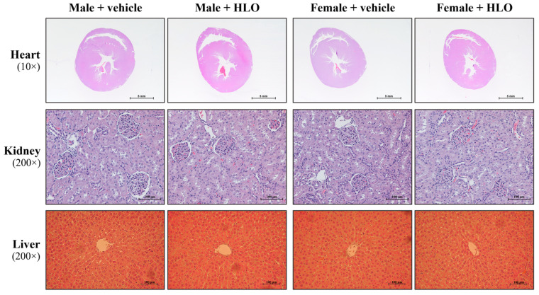 Representative image of hematoxylin and eosin (H&E) staining of the ventricular cross-sectional morphology, kidney tissue section, and liver tissue section from the 28-day repeat-dose oral administration study in Sprague-Dawley rats, observed under a light microscope (image magnification and scale bar as indicated). HLO, hemp leaf oil.