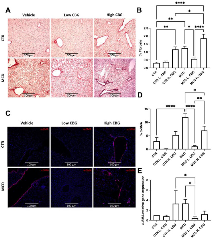 Liver fibrosis was measured by Picro-Sirius Red staining, α-SMA staining and mRNA gene expression. Representative pictures and quantification of collagen deposition in liver frozen section (A,B, 10×). α-SMA immunofluorescence staining and quantification (C,D, 20×) showing α-SMA in red and DAPI (nucleus) in blue (D). Quantification of α-SMA mRNA gene expression (E). * p < 0.05, ** p < 0.01, **** p < 0.0001.