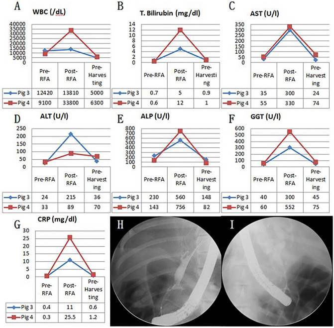 Blood test and cholangiography of biliary stricture pre-RFA, post-RFA, and at 3-month follow-up. (A) WBC changes; (B) T. bilirubin changes; (C) AST changes; (D) ALT changes; (E) ALP changes; (F) GGT changes; (G) CRP changes of 3-month follow-up pigs; (H) Cholangiography of biliary stricture of 3-month follow-up (pig 3); (I) Cholangiography of biliary stricture of 3-month follow-up (pig 4). WBC white blood cell count, T. bilirubin total bilirubin, AST aspartate transaminase, ALT alanine transaminase, ALP alkaline phosphatase, GGT gamma-glutamyl transferase, CRP C-reactive protein.