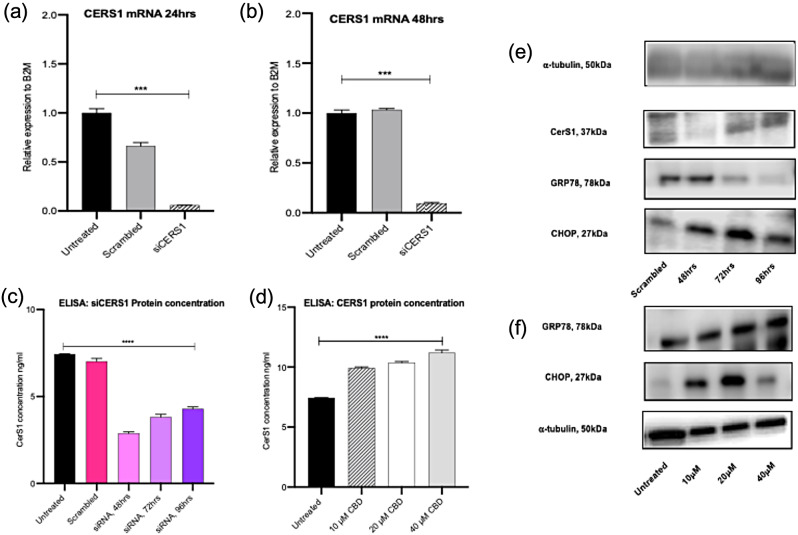 Ceramide synthase 1 knockdown causes reduction of GRP78 in Panc1 cells. (a) and (b) qPCR for CerS1 mRNA following transfection with 5 nM si-CERS1 for 24 and 48 h. (c) Bar blot of protein concentration (ng/ml) of CerS1 using ELISA following transfection with 5 nM si-CERS1 for 48, 72 and 96 h. (d) Bar blot of protein concentration (ng/ml) of CerS1 using ELISA following 48 h treatment with cannabidiol at 10, 20 and 40 µM. (e) Western blot (s) of housekeeping gene, alpha-tubulin, CerS1, GRP78 and CHOP following siRNA treatment. (f) Western blot (s) of GRP78, CHOP and alpha-tubulin following 48 h treatment with cannabidiol at 10, 20 and 40 µM