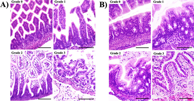 Pictures of histological sections (x40) of the small intestine (A) and large intestine (B) with haematoxylin-eosin staining of the 4 degrees of histological damage due to enterocolitis. Grade 0 = healthy intestine; Grade 1 = detachment of enterocytes and mild wall separation; Grade 2 = detachment of enterocytes and severe wall separation; Grade 3 = epithelial villous detachment/cell rupture. Scale 100 microns