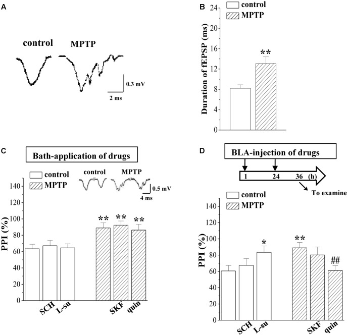MPTP-induced dopamine depletion attenuates GABAergic neurotransmission. (A) Representative traces of fEPSP evoked by 0.5 mA/SI in control mice (control) and MPTP-mice (MPTP). (B) Bar graphs show the mean duration (ms) of fEPSP in control mice and MPTP-mice. ∗∗p < 0.01 vs. control mice. (C,D) Bar graphs show the PPI (25 ms IPI, %) in the slices of control mice treated with SCH23390 (SCH) or L-sulpiride (L-su) for 20 min; in the slices of MPTP-mice treated with SKF38393 (SKF) or quinpirole (quin); in control mice treated with BLA-injection of SCH23390 (SCH) or L-sulpiride (L-su) for 2 days; in MPTP-mice treated with BLA-injection of SKF38393 (SKF) or quinpirole (quin). (D) Time chart of the experimental procedure (upper panel). ↓: time of drug administration; ↘: time of electrophysiological experiments. ∗p < 0.05 and ∗∗p < 0.01 vs. control mice; ##p < 0.01 vs. MPTP-mice (two-way ANOVA).
