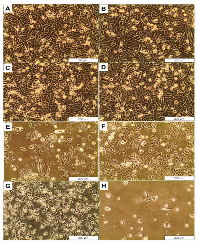 Cellular morphology of A375 cells post treatment with CBD and ZnPcTS41. untreated cells (A); Cells + laser irradiation (B); Cells + ethanol (C); 5.3 µM ZnPcTS4 (D); 0.63 µM CBD (E); 0.63 µM CBD + 5.3 µM ZnPcTS4 (F); 5.3 µM ZnPcTS4 + irradiation (G); 5.3 ZnPcTS4 + irradiation + 0.63 µM CBD (×100 magnification) (H).