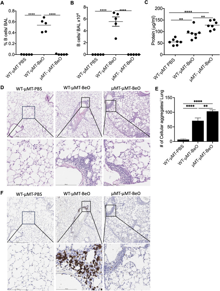 Adoptively transferred B cells protect against BeO-induced lung injury. μMT mice were adoptively transferred with wild-type B cells purified from the spleen or with splenocytes from μMT mice. Recipient mice were sensitized and boosted with BeO using the previously described protocol. Percent frequency (A) and total number of B cells (B) in the BAL of BeO-exposed mice as examined on day 21. (C) Protein leak in the bronchoalveolar lavage fluid (BALF) of μMT mice adoptively transferred with WT splenic B cells or μMT splenocytes and exposed to BeO on day 21. (D) Hematoxylin and eosin staining show low magnification (top) and high magnification (bottom), and (E) cellular aggregates quantified in the lungs of mice adoptively transferred with WT splenic B cells or splenocytes from μMT mice into μMT mice and exposed to BeO. Cellular aggregates were quantified using QuPath. (F) Immunohistochemical (IHC) staining of B cells low magnification (top) and high magnification (bottom) on day 21 using an anti-rabbit B cell antibody in the lungs of mice adoptively transferred with WT splenic B cells or splenocytes from μMT mice into μMT mice and exposed to BeO. Data are representative of three independent experiments, 3-5 mice per group. One-way ANOVA was used to test statistical differences among the groups. P<0.05 (*) is considered statistically significant. P < 0.01 (**), P <l 0.0001 (****).