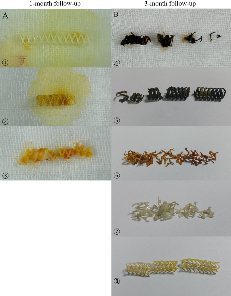 Gross morphology of polycaprolactone stents 1 month and 3 months after insertion. (A) Most stents maintain color and integration, 1 month after insertion. Specimen 3 was damaged by surgical instruments during common bile duct extraction. (B) At 3 months after stent insertion, most stents show discoloration and fragmentation. Specimens 6, 7, and 8 are prototype stents.