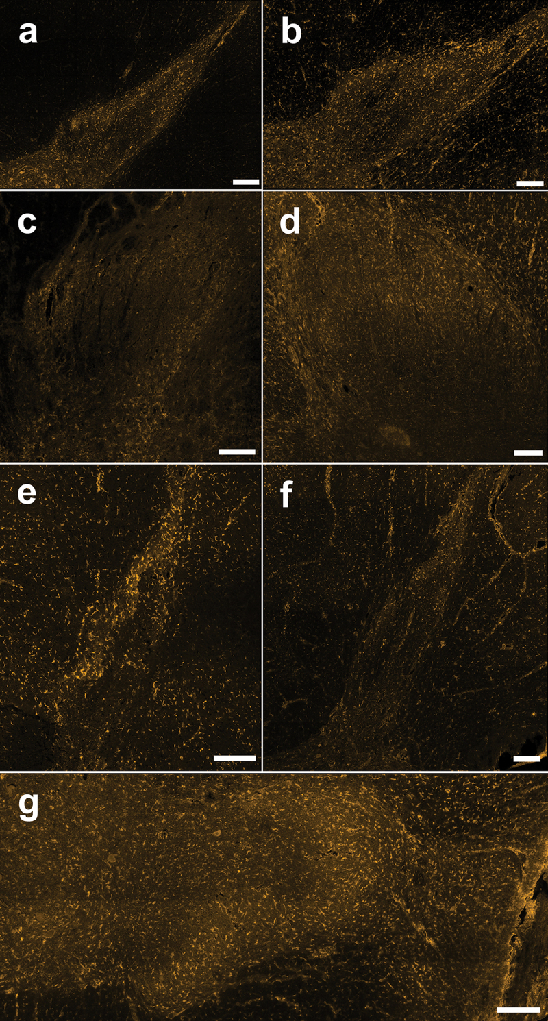 Immunoreactivity of the CB1 receptor in thoracic and lumbar spinal cord sections from male human organ donors. (A)–(G) Representative confocal images (20× objective) of CB1 immunostaining from each male human (n = 7) showing neuropil staining that is especially pronounced in the SDH and cellular staining across the DH. Scale bar = 200 µm.