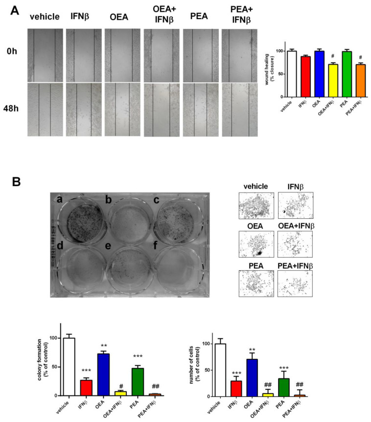 OEA, PEA, and IFNβ effect on cell proliferation and clonogenicity. Cells were treated for 48 h with the vehicle, OEA or PEA (3 µM), and IFNβ (5 ng/mL). Representative images show the scratch wound healing assay performed on treated SH-SY5Y cells. The percentage of wound closure in the scratch assay was measured. Values are reported as the mean ± SEM of four experiments. # p < 0.05 versus IFNβ. Magnitude 10× (A). Cells were seeded at a cell density of 200 cells/well in a six-well plate for the clonogenic assay and were exposed to (a) vehicle; (b) IFNβ 5 ng/mL; (c) OEA 3 µM; (d) OEA + IFNβ; (e) PEA 3 µM; or (f) PEA + IFNβ. Cells were stained with crystal violet to visualize colonies formed by 50 or more cells. Representative pictures of cell density were taken under a microscope after treatment. The number of formed colonies and the number of cells present in each well were quantified and are represented above as percentage of control (vehicle). ** p < 0.01 and *** p < 0.001 versus vehicle-treated cells; # p < 0.05 and ## p < 0.01 versus IFNβ. Values are reported as the mean ± SEM of four experiments (B).