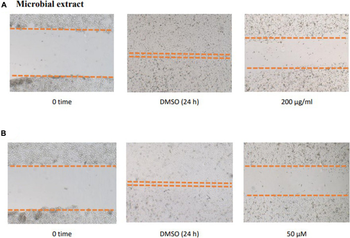 Effect of the microbial extract (A) and acetylaszonalenin (B) of the motility of human PC-3 prostate cancer cells in the wound healing assay. Microphotographs represent the wound at the creation time (t0) and 24 h post treatment in DMSO- (negative control) and acetylaszonalenin-treated wells.