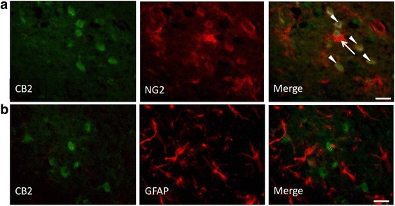 Double-immunostaining for CB2 (green) and GFAP (red) in the peri-infarct area (a). NG2+/CB2+ cells were round (arrowhead) and NG2+/CB2− cells were in a ramified form (arrow). b Double-immunostaining for CB2 (green) and NG2 (red) in the peri-infarct area on day 1 post PIT treatment. Scale bar, 25 μm