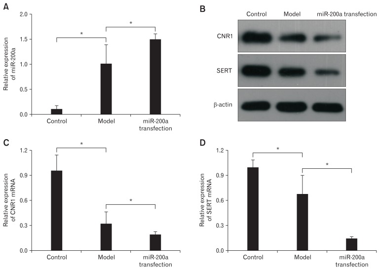 MicroRNA-200a (miR-200a) inhibited the expression of cannabinoid receptor 1 (CNR1) and serotonin transporter (SERT) in diarrhea-predominant irritable bowel syndrome colonic epithelial cells (CECs). (A) Quantitative real-time polymerase chain reaction (qRT-PCR) showed that miR-200a expression was significantly higher in the miR-200a transfection group than in the model group and the control group, indicating successful transfection (*P < 0.05, ANOVA and least significant difference [LSD]). (B) The western blot showed a significant reduction in the expression of CNR1 and SERT in the miR-200a group. (C, D) Quantitative RT-PCR shows similar results with western blot (*P < 0.05, ANOVA and LSD).