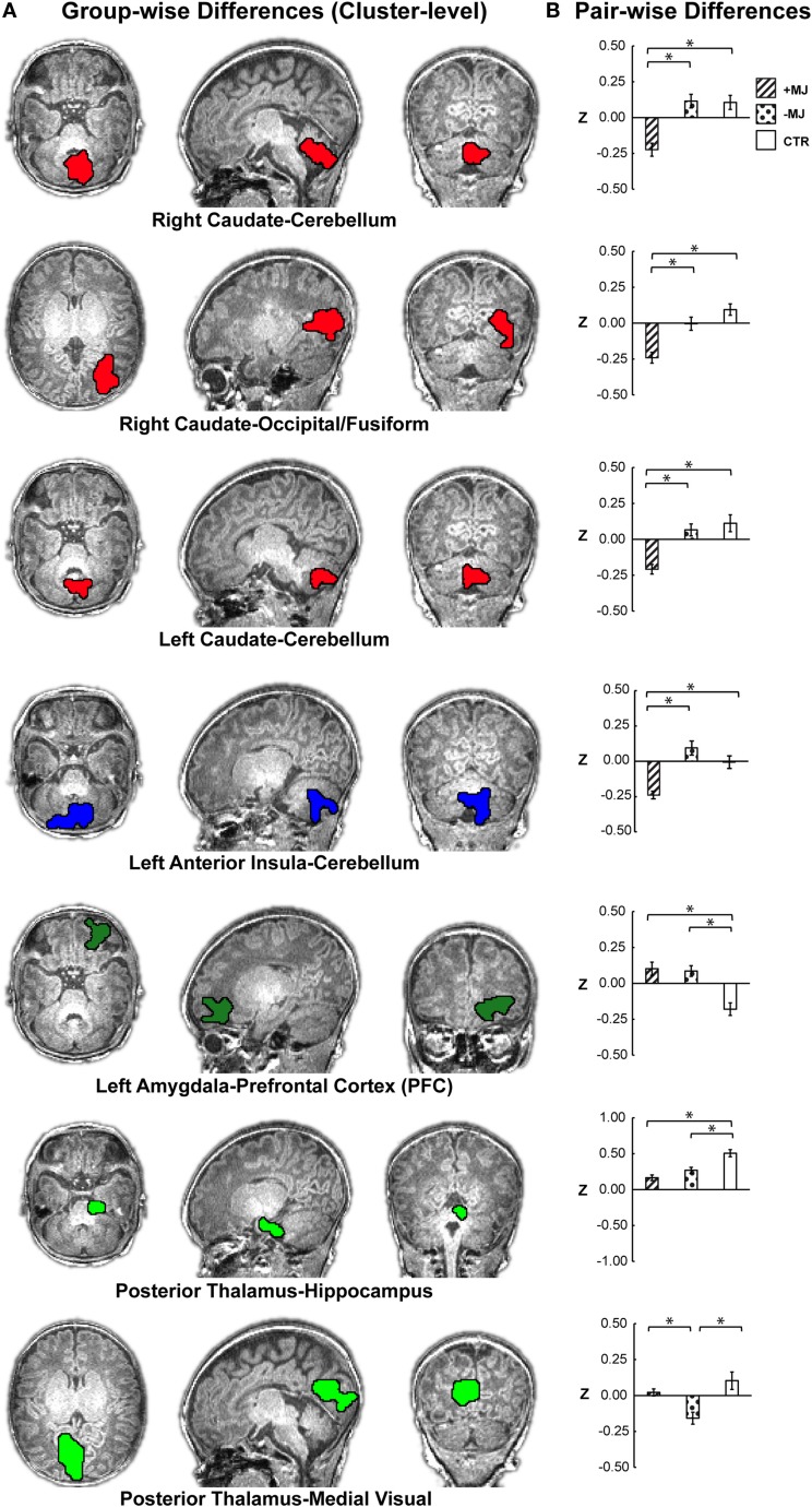 Localization of group-level (+MJ, −MJ, CTR) functional connectivity differences at the cluster level and comparisons by group. (A) Clusters depicted on the high-resolution anatomical reference images. Clusters were detected using the combined threshold approach controlling for gestational age, birth weight, scan age, gender, and scanner (α < 0.05): multivariate group-wise difference (+MJ, −MJ, CTR) p ≤ 0.01, minimum number of voxels = 32, nearest neighbor clustering (NN) = 3. (B) Comparisons of functional connectivity within cluster by neonatal group. (*) indicates significant (p ≤ 0.05 Dunn–Sidak corrected) pair-wise differences between groups while accounting for participant characteristics. Data plotted as mean ± SEM.