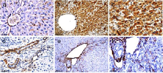 Immunohistochemical detection of α-SMA (×40 & ×80). Sham group shows a negligible positive reaction (a), bile duct ligated group shows highest reaction (b & c), group treated with silymarin shows decrease in reaction (d), while AM1241 treated group shows a more noticeable decrease in reaction (e & f)
