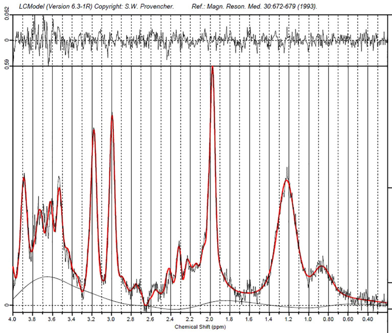 Spectroscopy graph displaying chemical shift on the x-axis from 4.0 to 0.0 parts per million and signal intensity on the y-axis. The main plot features peaks of varying heights, marked in black with a red overlay, indicating different chemical constituents. The corresponding residual plot above shows smaller fluctuations. Vertical dashed lines provide reference points across the graph.
