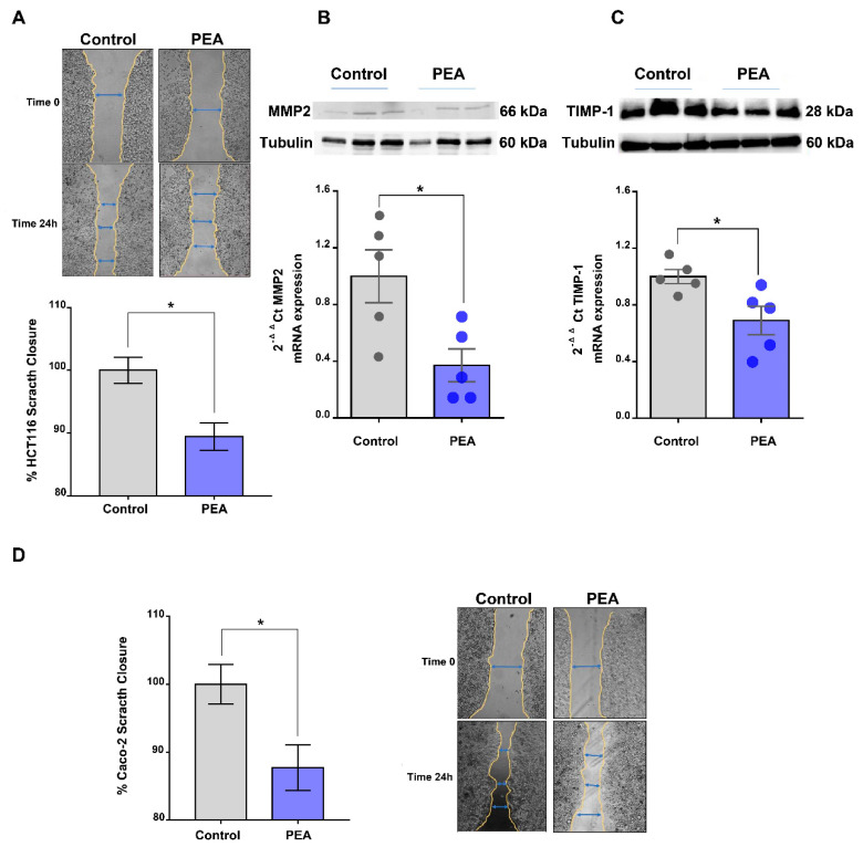 Palmitoylethanolamide affects tumor cell migration. (A) In vitro scratch assay performed in HCT116 cells alone or in the presence of ultramicronized palmitoylethanolamide (PEA, 30 μM, 24 h). The scratches are expressed as a percentage of scratch closure (n = 4 experiments). Representative images of the scratch areas, at time zero and 24 h, of HCT116 cells alone or in the presence of PEA (30 μM, 24 h) are reported on top of the graph. Gene and protein expressions of matrix metalloproteinase type 2 (MMP2). Magnification: 4×. (B) and tissue inhibitor matrix metalloproteinase 1 (TIMP1) (C) in HCT116 cells, alone or in the presence of PEA (30 μM, 24 h). Gene expression was measured by RT-qPCR and calculated by using the 2-ΔΔCt formula (n = 5), whereas protein expression was evaluated by Western blot analysis and normalized to the housekeeping protein α-tubulin (n = 3). Detailed information about Western Blot can be found at Supplementary Materials. (D) In vitro scratch assay performed in Caco-2 cells alone or in the presence of PEA (30 μM, 24 h). The scratches are expressed as percentage of scratch closure (n = 4 experiments). Next to the graph, representative images of the scratch areas at time zero and time 24 h for Caco-2 cells alone or in the presence of PEA (30 μM, 24 h) are reported. Values are expressed as means ± SEM; * p < 0.05 vs. control as assessed by Student’s t-test. Magnification: 4×.