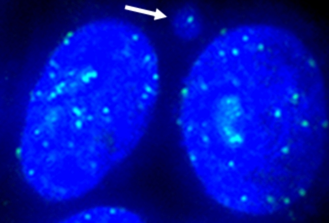 Representative image of kinetochore analysis. Nuclei (blue) were stained with Hoechst 33,258, and kinetochores (green) with primary anti-centromere and FITC-conjugated secondary antibodies. The arrow indicates the micronucleus with the kinetochore signal