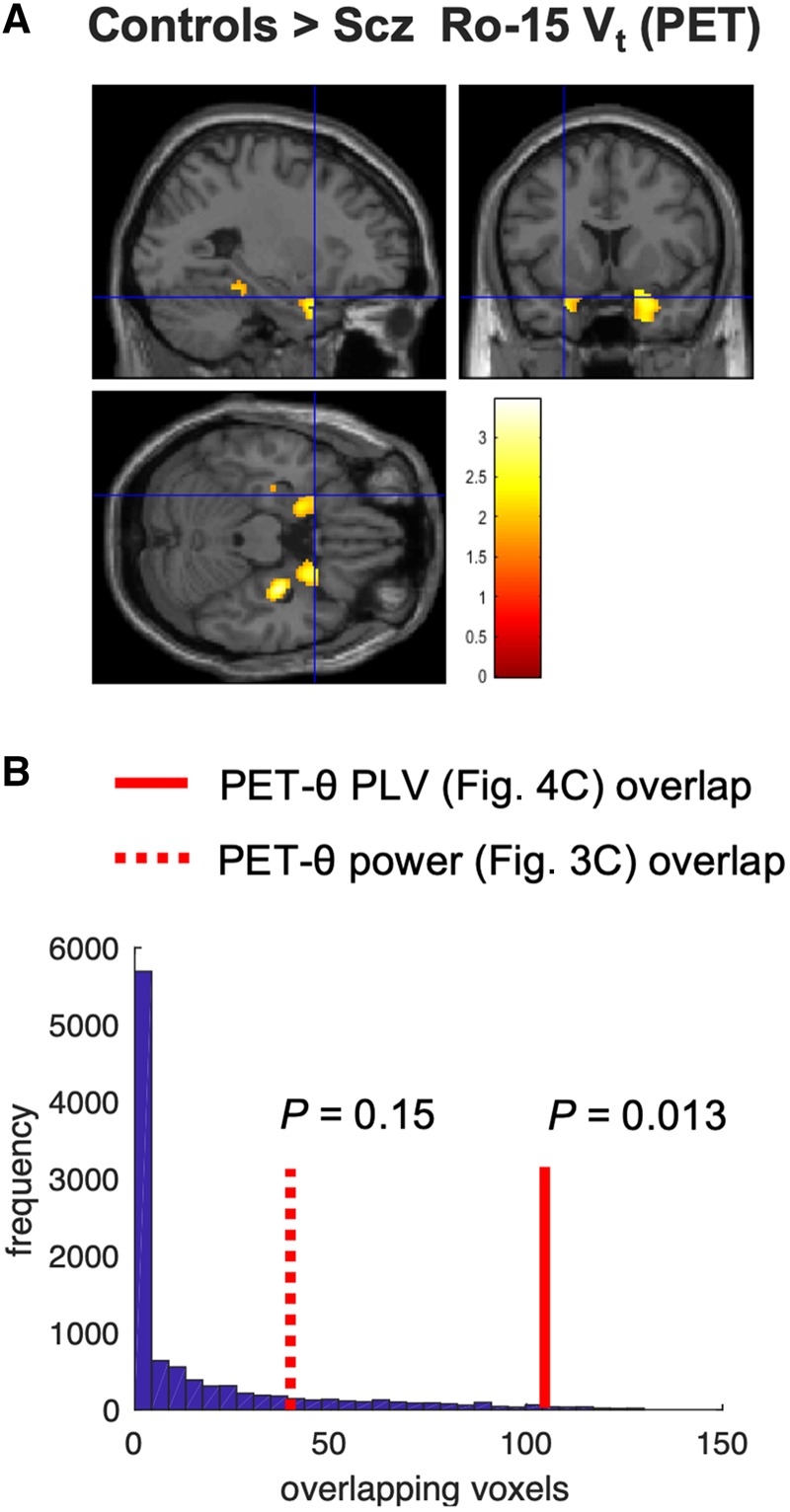 PET analysis. (A) A reanalysis of PET data presented by Marques et al. (2020), who found reduced α5-GABAAR availability in hippocampus in subjects with schizophrenia (Scz). We performed a voxel-wise analysis of these data to look for any overlap between areas of α5-GABAAR reduction and cue-related PLV decrease. At reduced threshold [Punc < 0.05], the schizophrenia group had four areas of reduced α5-GABAAR availability >100 voxels in size: two in right anterior mTL [peak (32 −12 −20), Z = 3.30, Punc < 0.001; peak (28 18 −34), Z = 2.75, Punc = 0.003], one in left anterior mTL [peak (−20 4 −26), Z = 2.40, Punc = 0.008] and one in posterior hippocampus [peak (−20 −34 −12), Z = 2.15, Punc = 0.016]. The third (anterior mTL) area overlapped with the areas of reduced theta power (Fig. 3C, right) and PLV (Fig. 4B) in schizophrenia subjects: the crosshairs are placed at the peak contrast voxel from Fig. 4B. (B) The probabilities of the overlaps between the Ro-15 PET controls > schizophrenia contrast in (A) and the theta power and PLV controls > schizophrenia contrasts in Figs 3C and 4B were assessed using permutation testing (10 000 permutations). This histogram plots the number of overlapping voxels expected by chance: the theta PLV effect overlap is unlikely to be due to chance (P = 0.013).