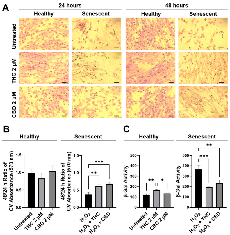 CV-stained fibroblasts, β-Gal activity, and 48/24 h CV assay ratio in healthy and SIPS CCD-1064Sk human dermal fibroblasts (PDL 24) exposed to 2 µM of THC or CBD. (A) Images of healthy and senescent fibroblasts stained with CV after 24 or 48 h of treatment. Scale = 50 μm. (B) The 48-to-24-h ratio of CV assay performed after treatment with THC or CBD exposure in healthy and SIPS fibroblasts. (C) β-Gal activity after 5 days of treatment with THC or CBD in healthy and SIPS fibroblasts. Data were analyzed with an ANOVA test followed by Tukey’s post-hoc multiple comparison test. Bars represent mean ± SEM, n = 3. Significance is indicated using the following scale: * p < 0.05, ** p < 0.01, *** p < 0.001. CBD, cannabidiol; CV, crystal violet; DMSO, dimethyl sulfoxide (vehicle); SIPS, stress-induced premature senescence; THC, delta-9-tetrahydrocannabinol.