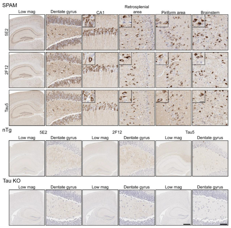 Immunohistochemical labelling of tau neuropathology in a mouse model of tauopathy with novel antibodies 5E2 and 2F12. Mouse brain tissue from a mouse model of tauopathy (SPAM), non-transgenic (nTg), and a tau null (Tau KO) mice was immunostained with 5E2, 2F12, and Tau5. An N of 9–11 SPAM and nTg mice were stained with 5E2 and 2F12. Scale bar for insets is 15 µm. Scale bar of high-magnification images is 50 µm. Scale bar of low-magnification images is 500 µm.