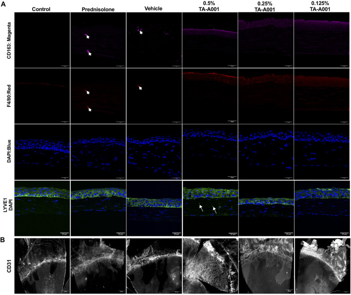 (A) Representative sections stained with antibodies against immune cells. Macrophages were stained with the F4/80 antibody (red), while M2 macrophages were localized by CD163 (magenta). LYVE1 staining (green) marks lymphatic vessels and macrophages. Blue, DAPI stained nuclei. Scale bars, 34 μm. (B) Flat mounts of alkali burned mouse corneas treated with different doses of TA-A001, drug vehicle or prednisolone for 14 days showing an increase in vascularization within the corneas of mice treated with the 0.5% dose of TA-A001. Scale bars, 300 µm.
