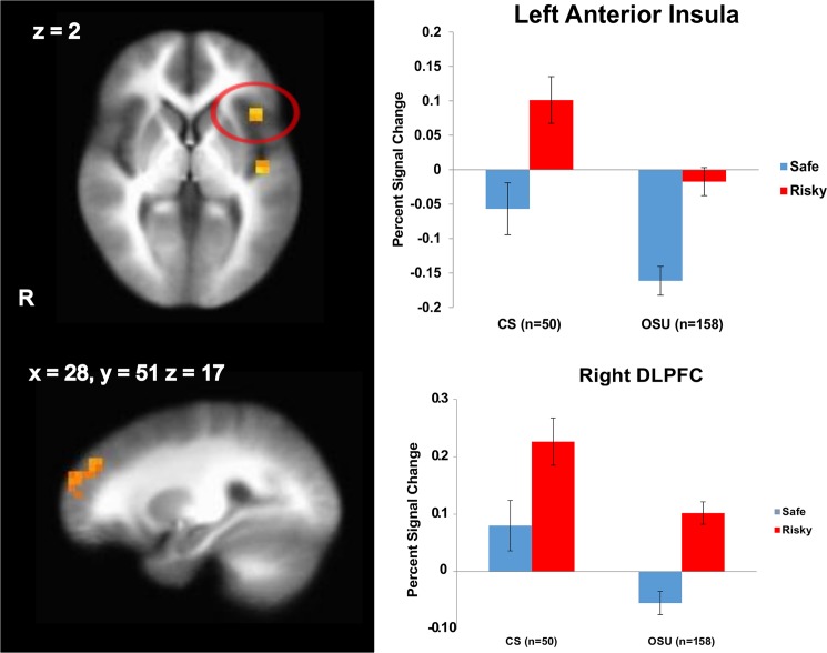 Occasional stimulant users (OSU) show an attenuated left anterior insula and right dorsolateral prefrontal (DLPFC) activation during risky and safe decision making.LME analysis results, group main effect (n = 208). Cluster significance of p < .05 corrected for multiple comparisons (voxel-wise probability: p < .05). R indicates right; error bars represent standard errors; CS = comparison subjects.