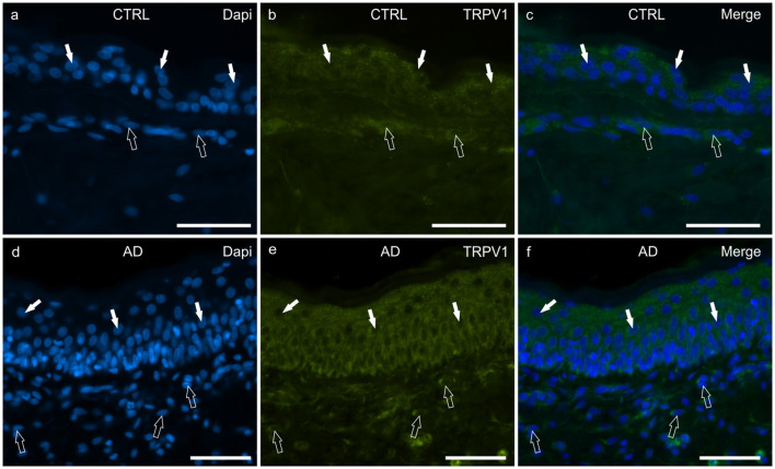 Photomicrographs of cryosections of canine skin showing transient receptor potential vanilloid 1 (TRPV1) immunoreactivity (IR) in the tissues of the healthy dogs (CTRL) (a–c) and in the dogs with atopic dermatitis (AD) (d–f). (a–c) The white arrows indicate some DAPI-labeled nuclei of the keratinocytes of the CTRL dogs showing moderate cytoplasmic TRPV1-IR. The open arrows indicate some DAPI-labeled nuclei of the dermal cells showing moderate TRPV1-IR. (d–f) The white arrows indicate some DAPI-labeled nuclei of the keratinocytes of the AD dogs showing bright cytoplasmic TRPV1-IR. The open arrows indicate some DAPI-labeled nuclei of the dermal cells showing bright TRPV1-IR. Bar, 50 μm.