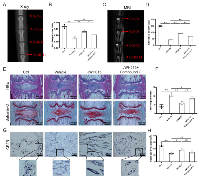 Local intervention of CB2R affects the degeneration of IVDD in rats. (A) X-ray examination of rat caudal at 1 week after surgery. (red arrows indicate different IVDs); (B) Disc height index (DHI) of rat caudal; (C) T2-weighted MRI scans of rat caudal at 1 week after surgery. (red arrows indicate different IVDs); (D) The optical density value of IVD; (E) H&E and safranin-O staining of rat caudal IVD (scale bar = 1000 μm); (F) Histological grade from the H&E and safranin-O staining; (G) Immunohistochemical staining results of CB2R (scale bar = 50 μm, black arrows indicate positive regions or cells); (H) Quantitation of CB2R expression in rat caudal IVD. Each experiment was conducted at least thrice, *p < 0.05, **p < 0.01.